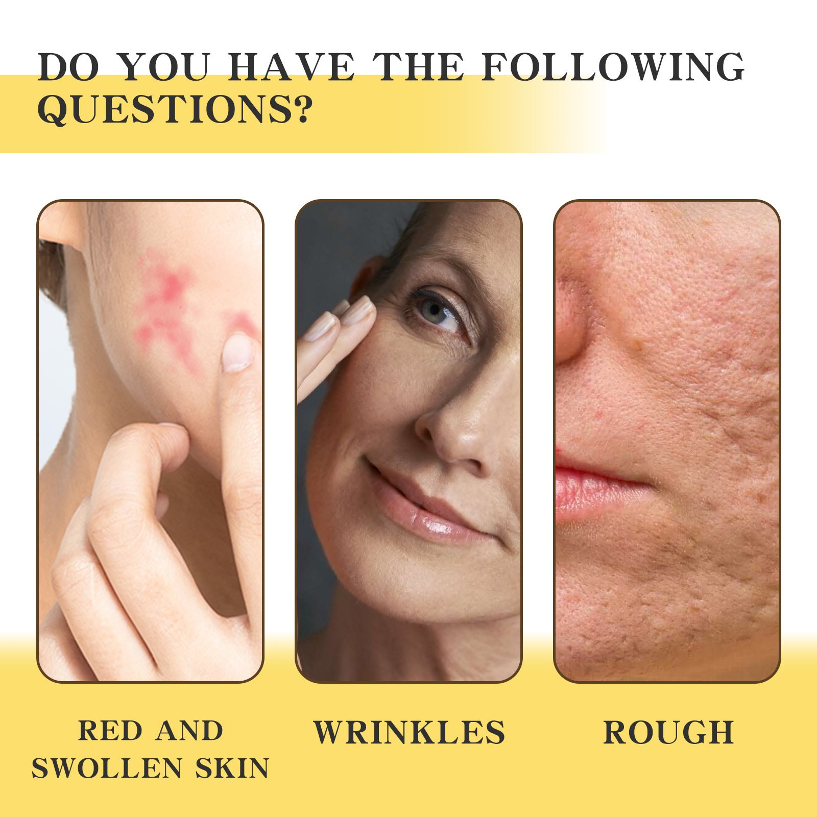OUHOE 50g propolis light cream moisturizing nourishing smoothing wrinkles fading red swollen skin relieving face cream