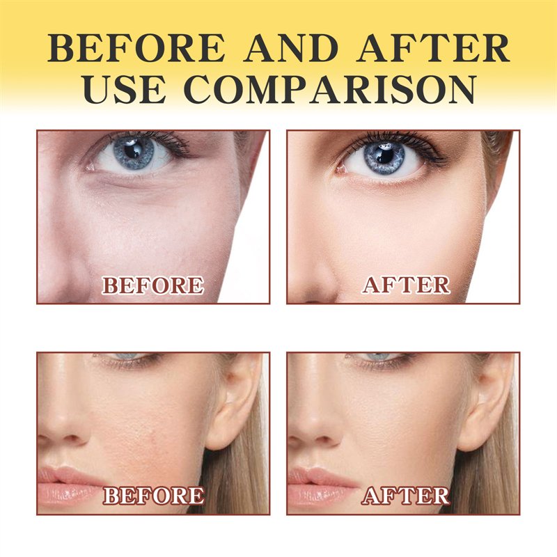 OUHOE 50g propolis light cream moisturizing nourishing smoothing wrinkles fading red swollen skin relieving face cream