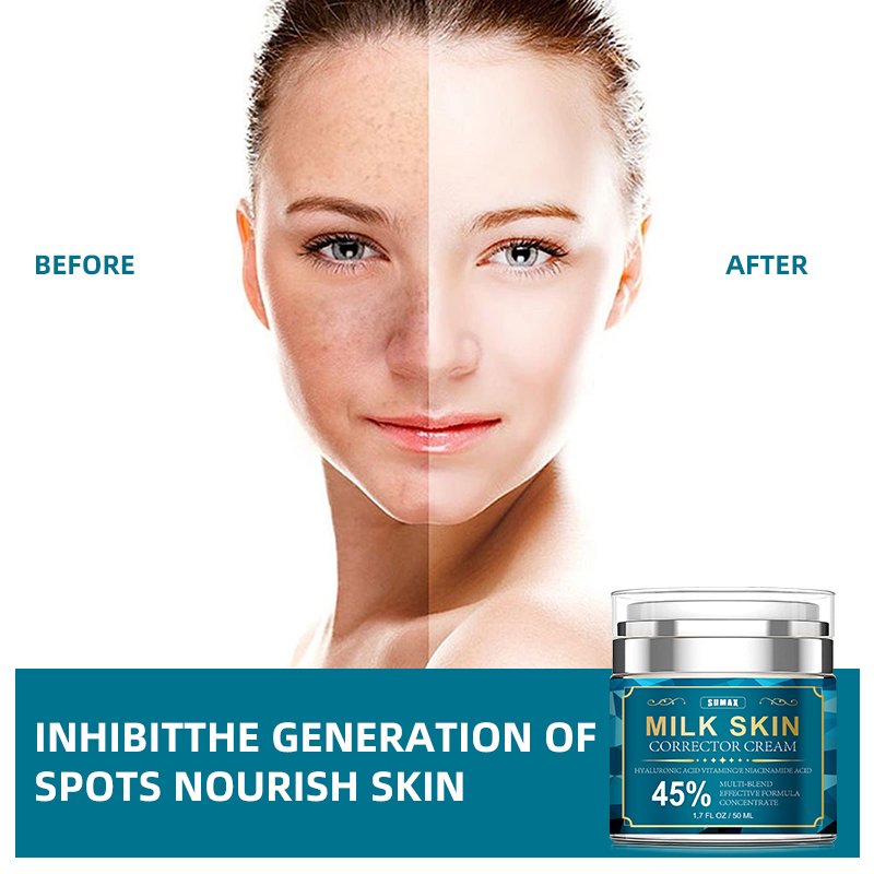 Face Body Sensitive Areas Dark Spot Corrector Cream Prevent Pigmentation For Underarms Elbows Privates