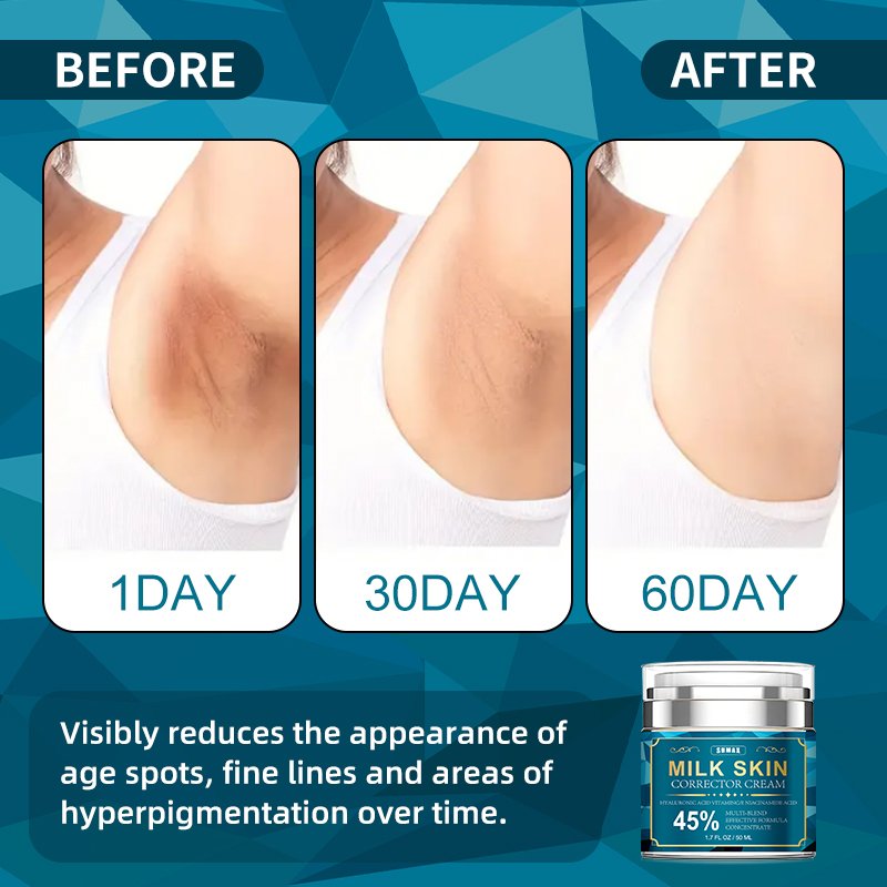 Face Body Sensitive Areas Dark Spot Corrector Cream Prevent Pigmentation For Underarms Elbows Privates