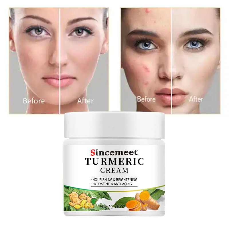 Hot Sale Custom Private Label Anti Aging Whitening Vitamin C Tumeric Cream Acne Treatment Dark Spot Removal Turmeric Face Cream