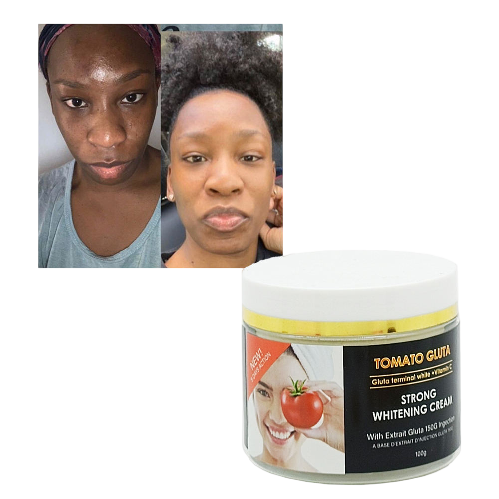 Beauty Black Spot Remover Face Cream Tomato Gluta Nourishing Moisturizer Face Whitening Cream for Dark Spots Removing