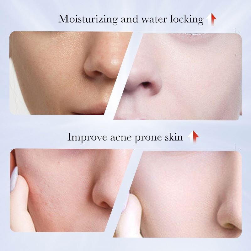 New arrival SADOER moisturize organic kojic acid face whitening cream for dark black skin