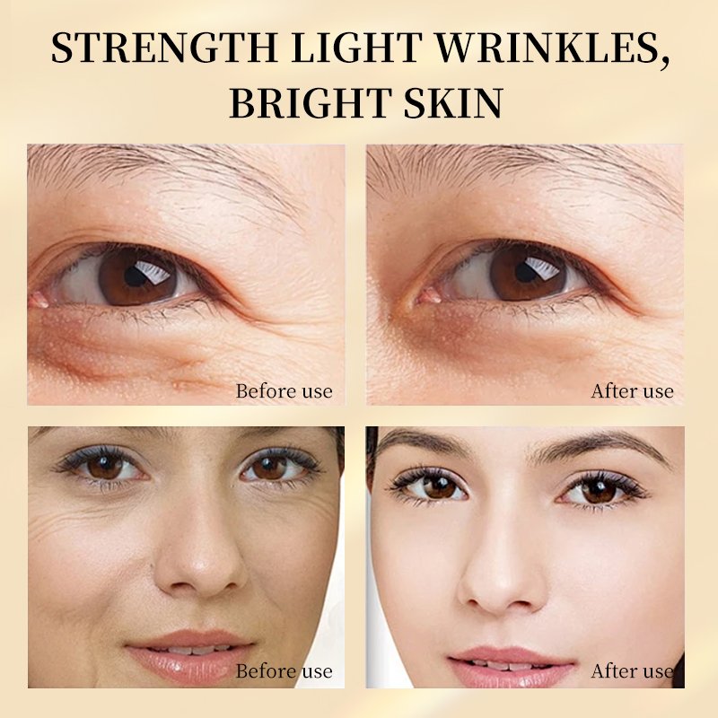 OEM Private Label Freckle Removing Moisturizing Hyaluronic Acid Repairing Brightening Skin Care Face Cream