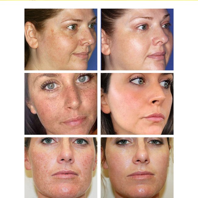 Hot Products Anti Aging Cream Organic Instant Brightening Whitening Face Cream