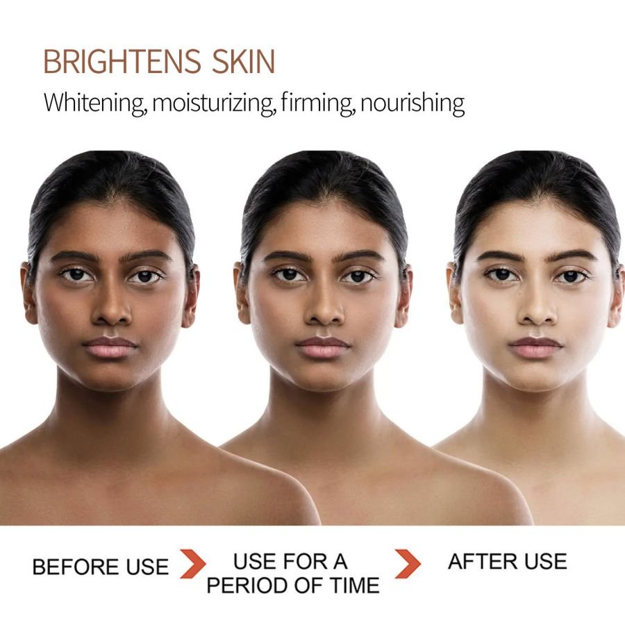 WHITENING CREAM 20g Vitamin C Kojic Acid Brightening Moisturizing Firming Skin Nourishing Whitening Face Cream