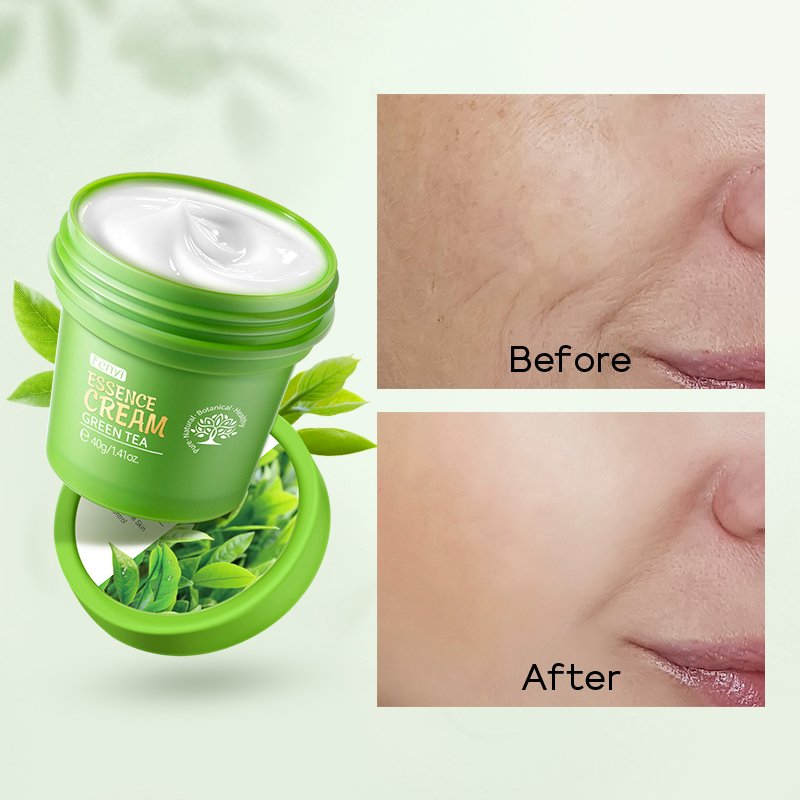 Fenyi Green Tea Oil Control Moisturizer face cream 40g face Beauty Anti Aging cream And Wrinkles face cream