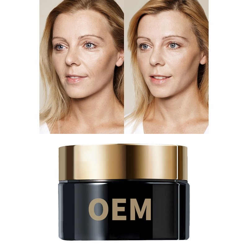 skin care,anti acne aging wrinkle fishtail lines removal hydrolyzed collagen repairing whitening face cream