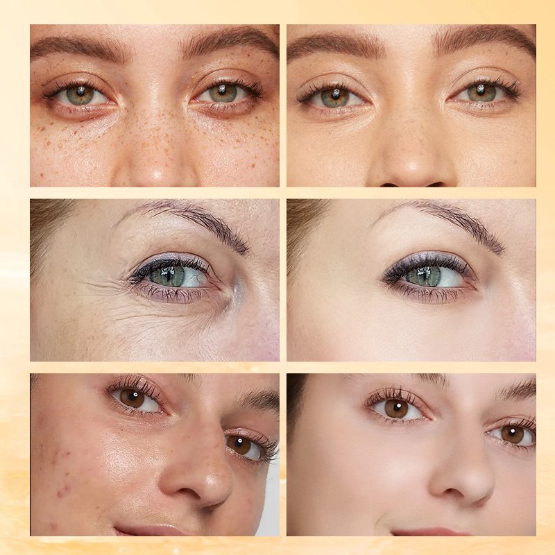 Skin care products Tranexamid Acid Vc Hyaluronic Acid Nicotinamide Even Skin Tone Brightening Fade Spots Face Cream