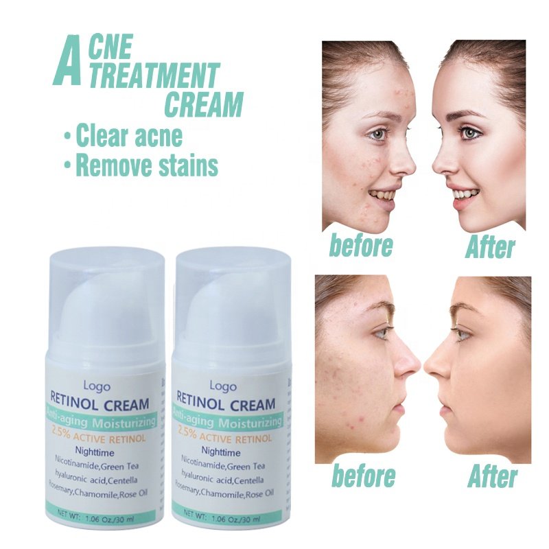 Private Label Pimples Treatment Oil Control Skin Repair Repair Acne Spot Removal Treatment Cream