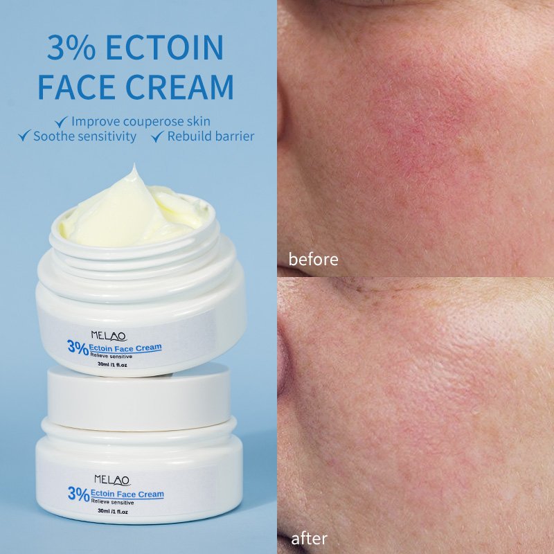 Private Label Dry Sensitive Skin Care Face Cream Replenishes Hydrating Intensive Moisturizing Cream Ceramide Face Cream