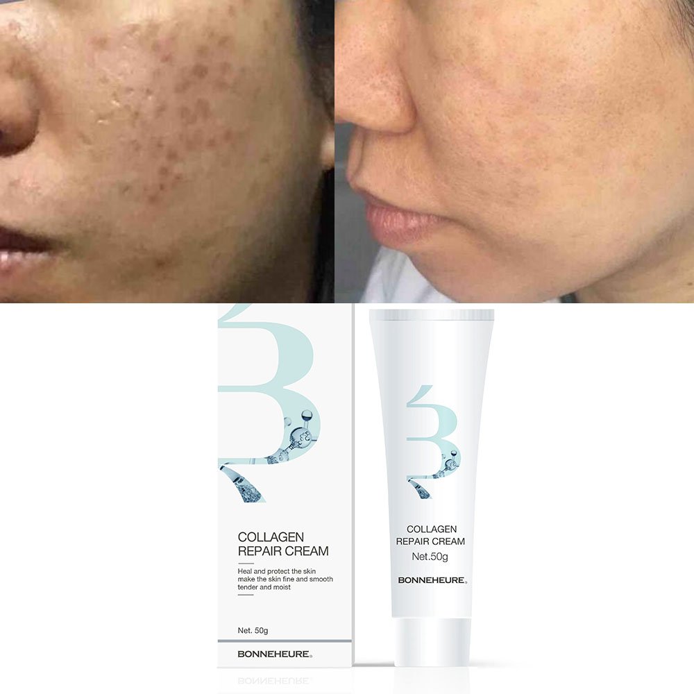 Men Facial Care Anti Wrinkle Cream Acne Treatment Skin Care Set Anti-aging Face Cream For Men