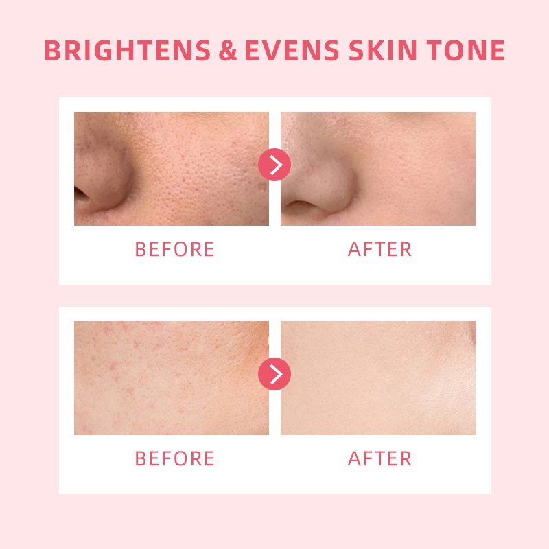 Wholesale 5x Ceramide MSH Niacinamide Brightening Moisture Gel Alpha Arbutin Tranexamic Acid Evens Skin Dark Spots Face Cream