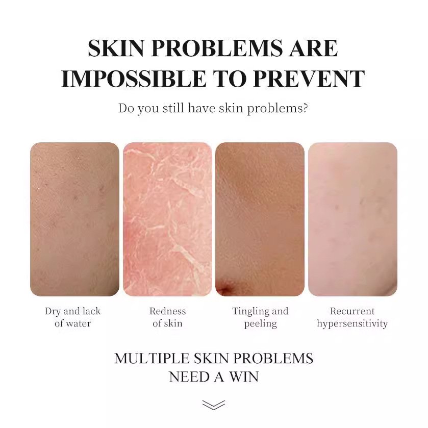 Snail Essence care skin care set improve skin quality Face cream Eye mask Essence Water cleansing gel wholesale Customization