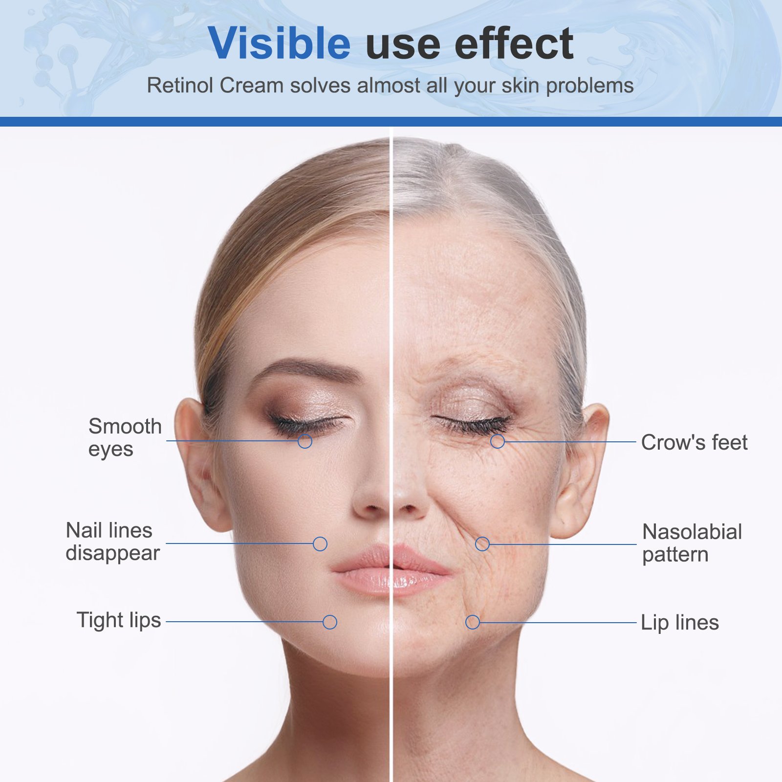Wholesale Best Face Cream Hyaluronic Acid Moisturizer Retinol Anti Aging Cream for Women