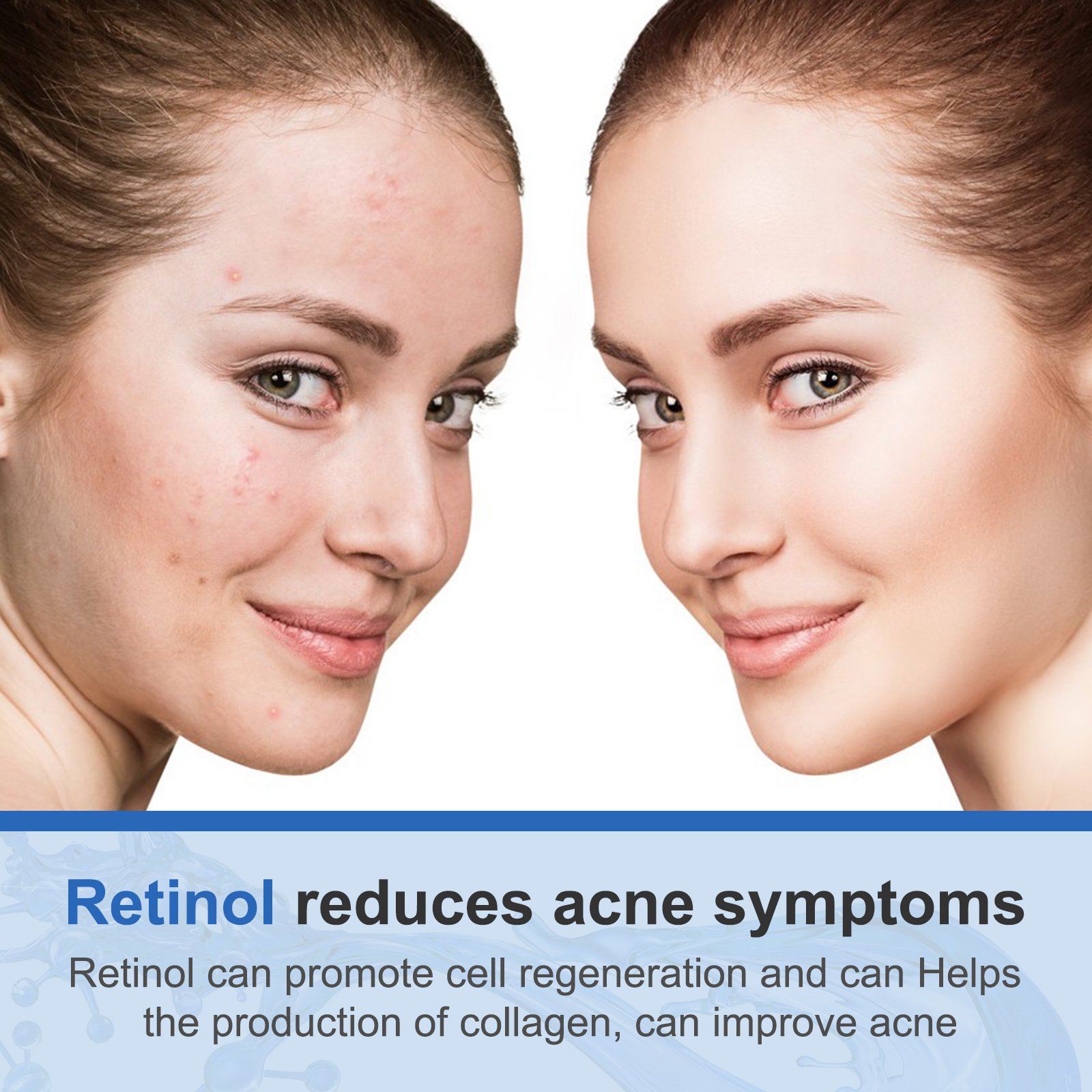 Wholesale Best Face Cream Hyaluronic Acid Moisturizer Retinol Anti Aging Cream for Women