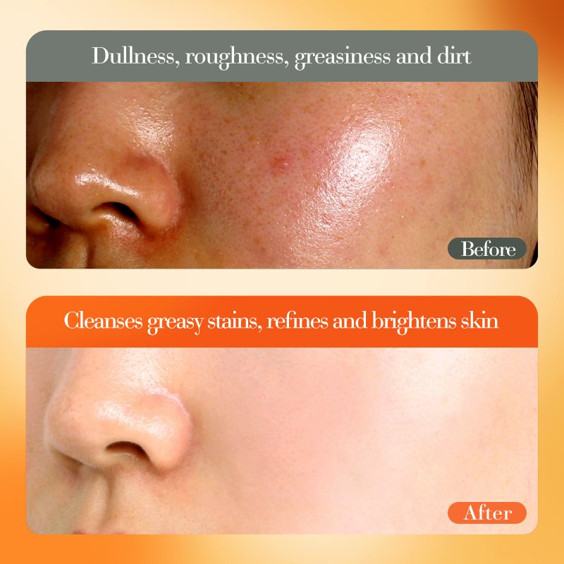 FAYANKOU Vitamin C Brightening Whitening Face Cream Lotion 50g Moisturizing And Nourishing Anti-Aging Moisturizing Essence Cream