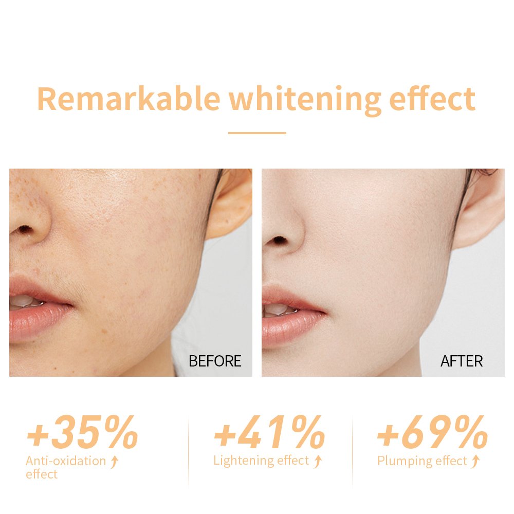 LANBENA Saudi Anti Aging Ginseng Green Tea Vitamin C Face Cream Whitening for Women The and Wrinkles Niacinamide Face Cream MSDS