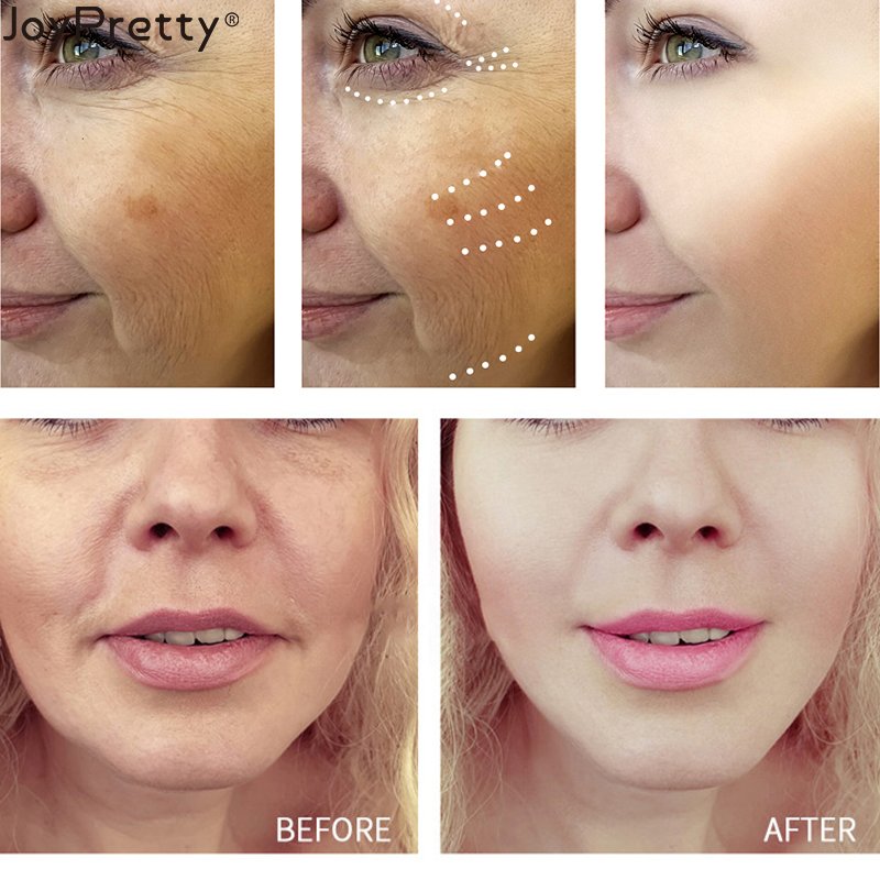 Hot selling organic Korean Retinol Face Cream Whitening Skin Collagen Moisturizer Anti Aging Wrinkle Retinol Cream
