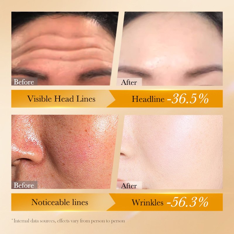 FAYANKOU Anti-Wrinkle Retinol Serum & Moisturizing Face Cream Beauty Product for Skin Care Set