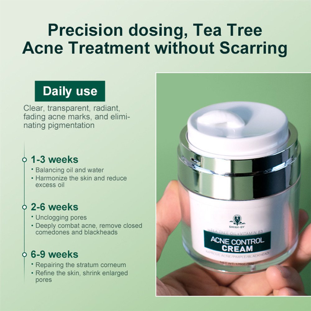 Private Label Anti Aging Control Acne Pimple Remove Anti Tea Tree Acne Treatment Face Cream