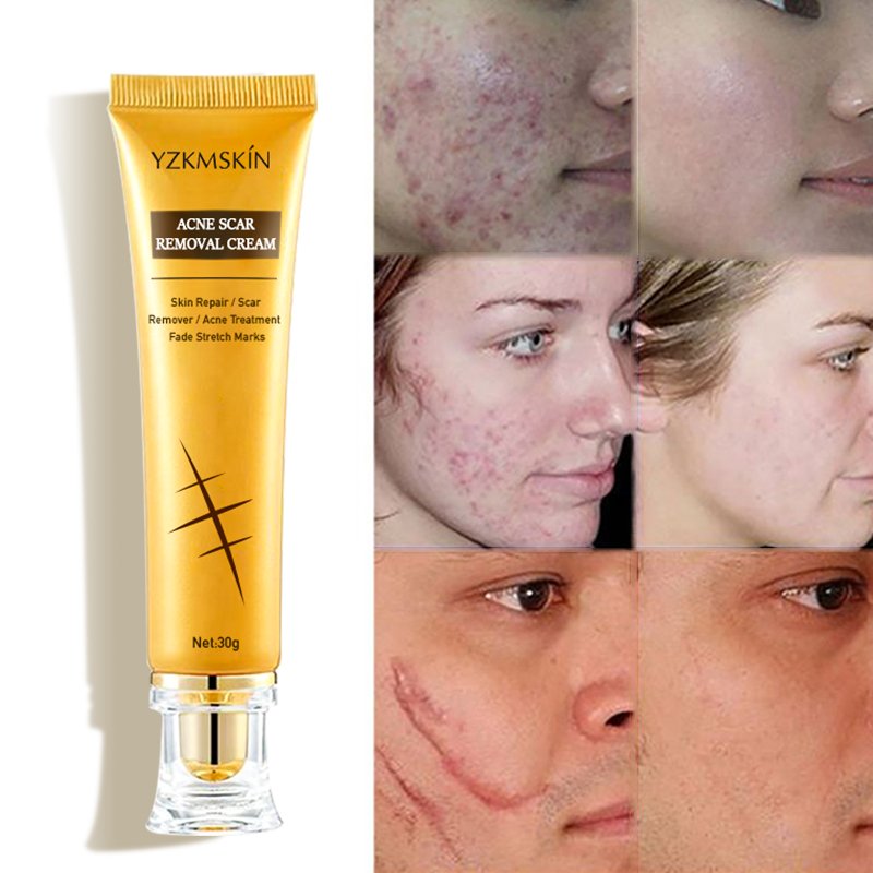 Collagen whitening anti aging face cream to remove dark spots vitamin c facial cream private label Acne Scar Removing face care