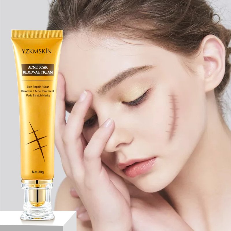 Collagen whitening anti aging face cream to remove dark spots vitamin c facial cream private label Acne Scar Removing face care