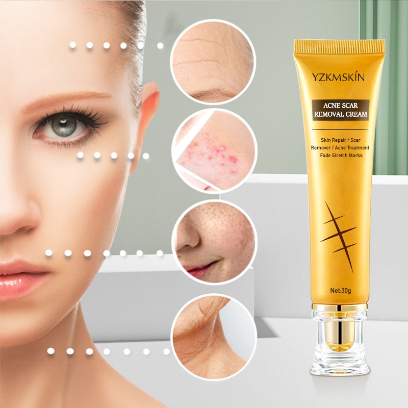 Collagen whitening anti aging face cream to remove dark spots vitamin c facial cream private label Acne Scar Removing face care