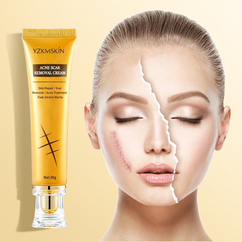 Collagen whitening anti aging face cream to remove dark spots vitamin c facial cream private label Acne Scar Removing face care