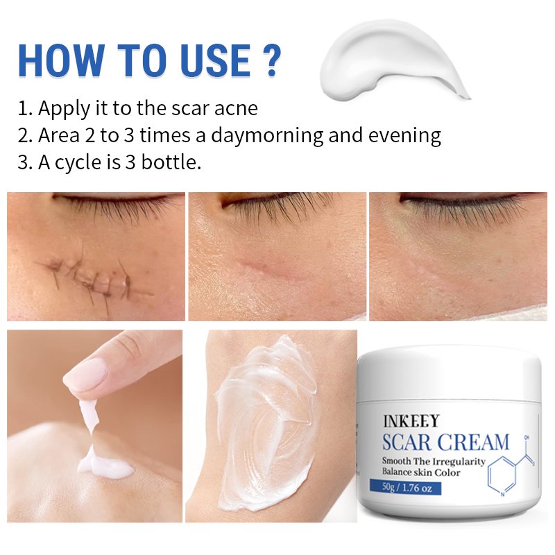 Hot selling effective scar remover old scar on face legs skin repair removal scar cream