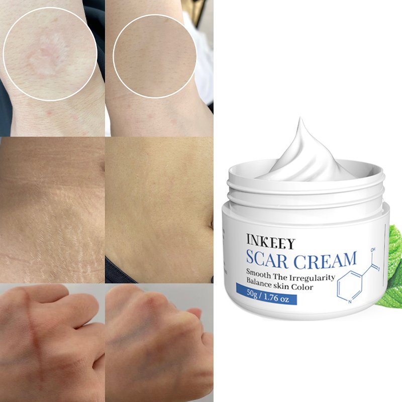 Hot selling effective scar remover old scar on face legs skin repair removal scar cream