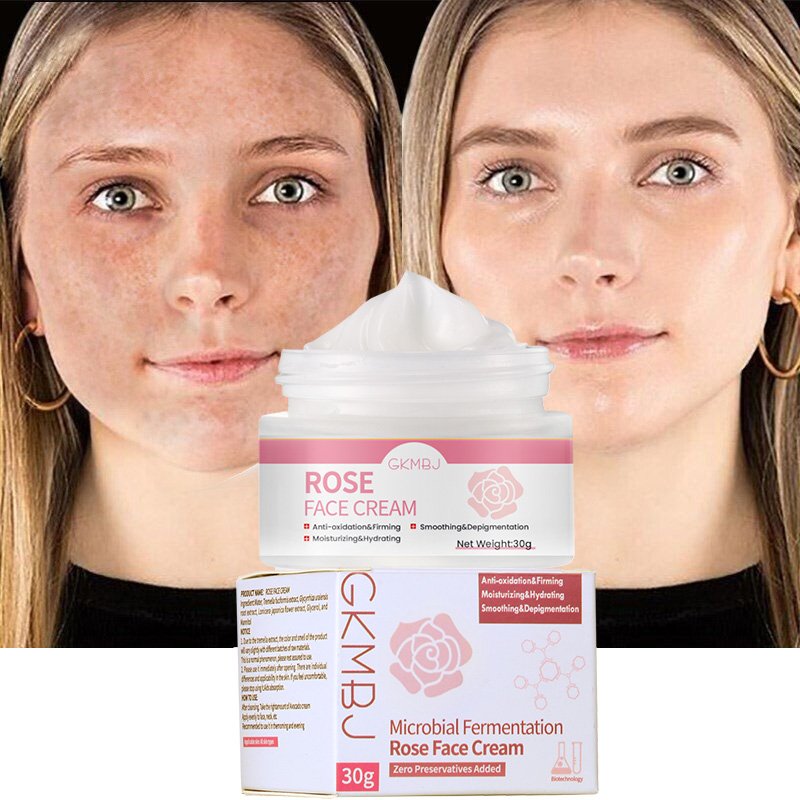 microbial ferment skin care,tremella dark stay up late lightening dark spot rough skin wrinkle remover,whitening rose face cream
