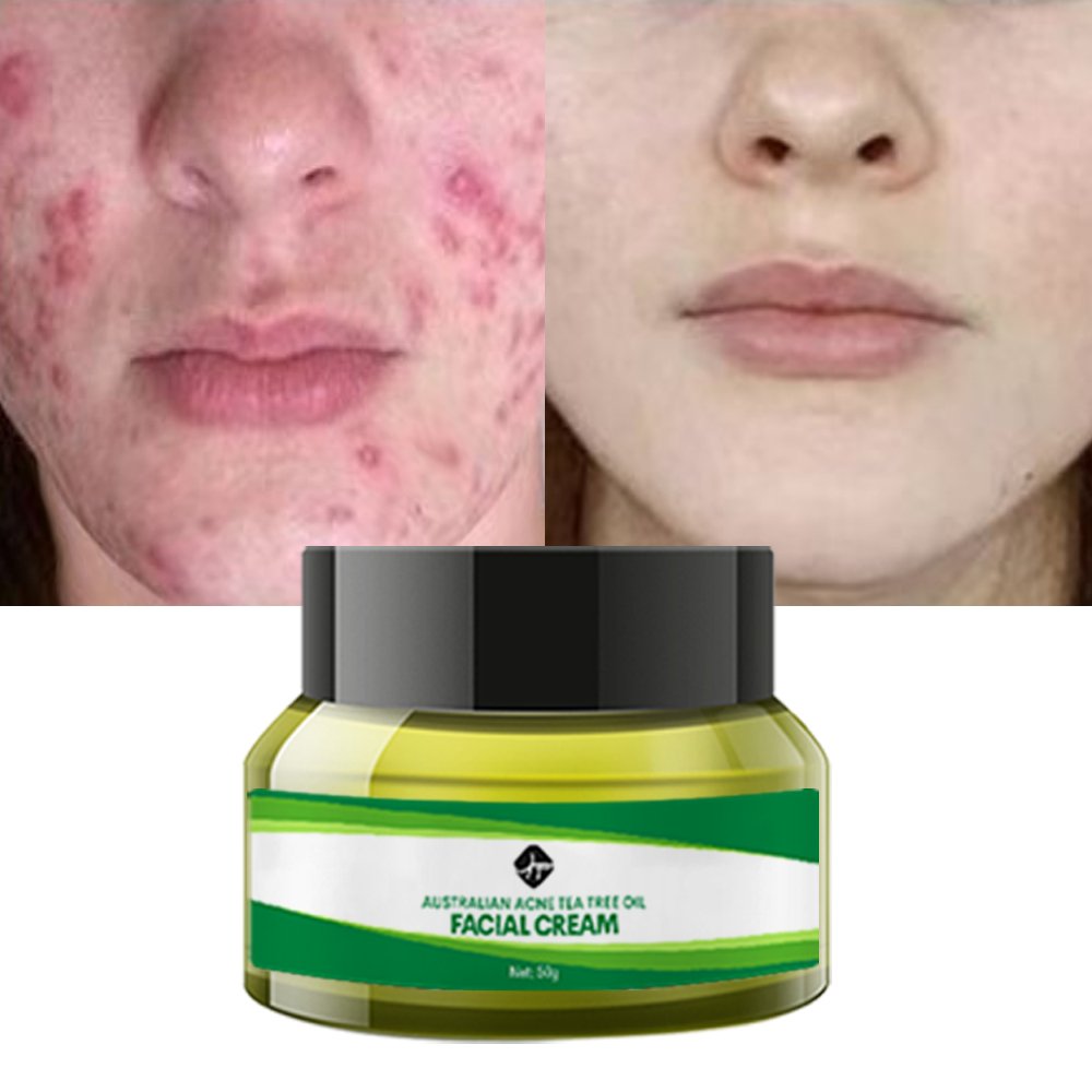 Wholesale Organic Facial Skin Care Revitalizer Moisturizer Face Lift Cream Hyaluronic Acid Anti Aging Retinol Face Cream