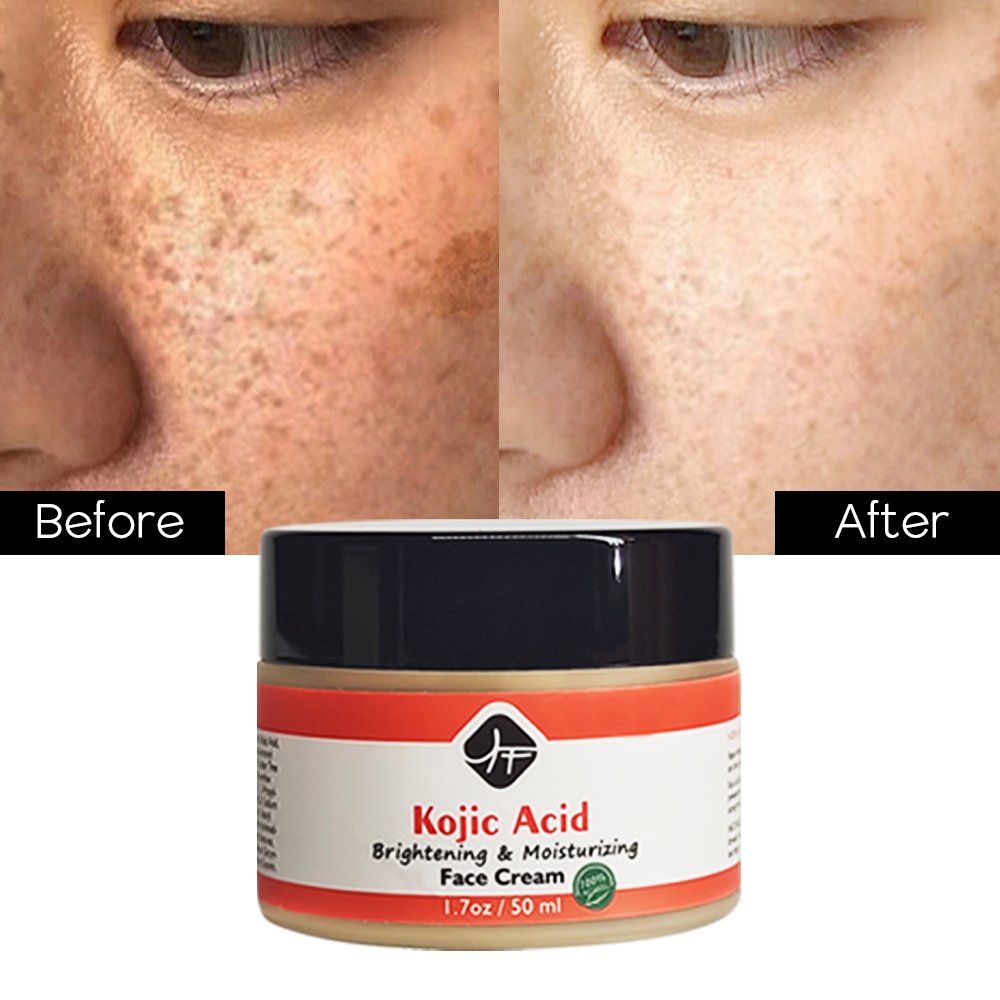 Wholesale Organic Facial Skin Care Revitalizer Moisturizer Face Lift Cream Hyaluronic Acid Anti Aging Retinol Face Cream