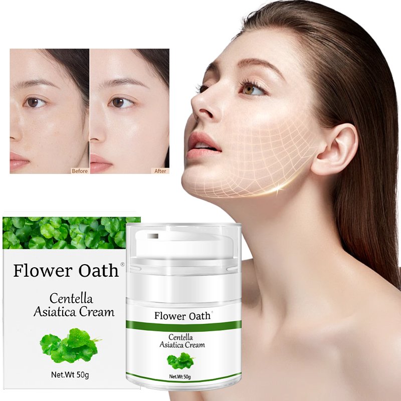 Block Sun and Remove Acne with Natural Face Cream and Whitening Ingredients 100ml 120ml Centella Asiatica Restoration face cream