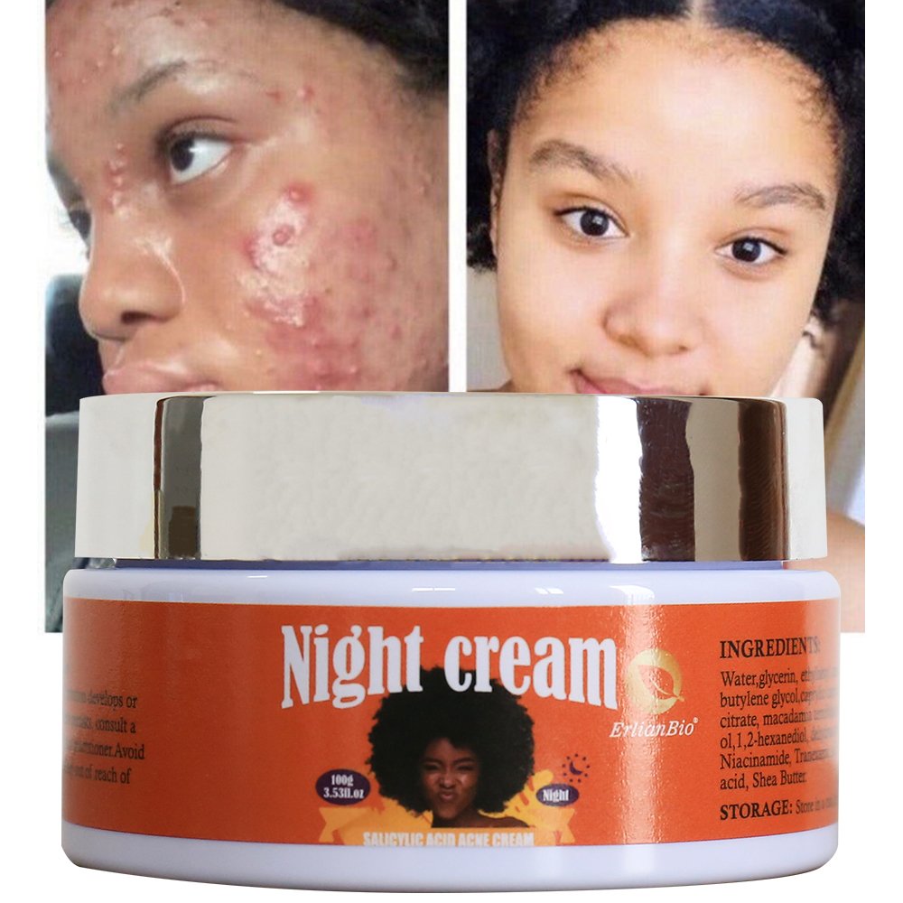 OEM wholesale high quality night cream repairing skin improving skin environment removing acne spots whitening night cream