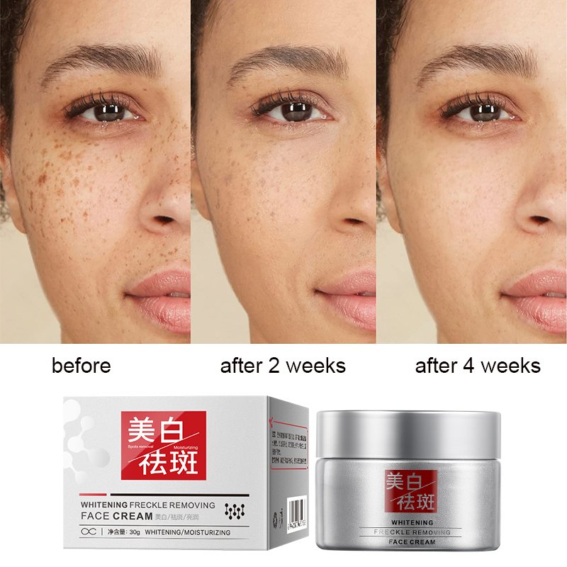 MOIKA High quality freckle cream Anti Aging Wrinkle Removal Dark Spot Strong bleaching whitening Collagen vitamin c face cream