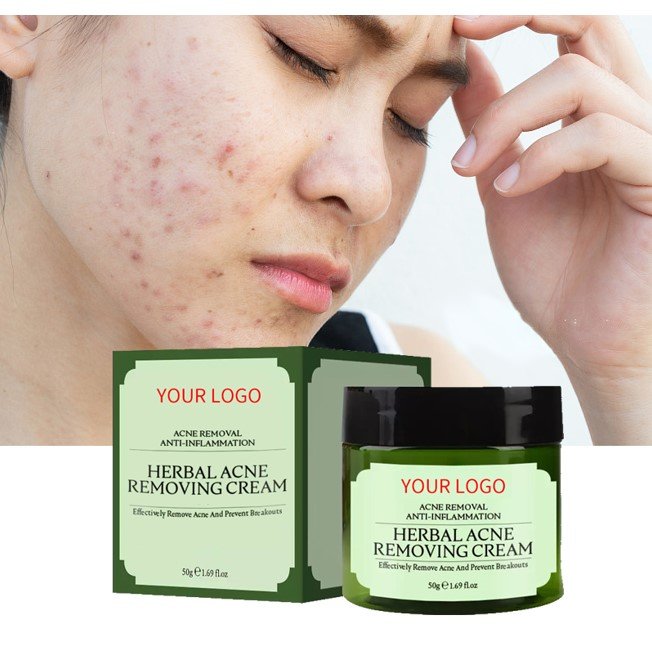 Wholesale Night Oil Control Skin Repair Acne Scar Pimples Removal Spot Treatment Tea Tree Oil Acne Face Cream