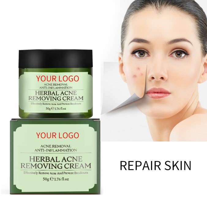 Wholesale Night Oil Control Skin Repair Acne Scar Pimples Removal Spot Treatment Tea Tree Oil Acne Face Cream