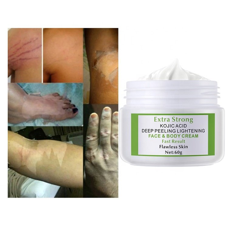 Private Label 60/100g Customized Extra Strong Kojic Acid 7days Lightening Whitening Peeling Body Face Cream
