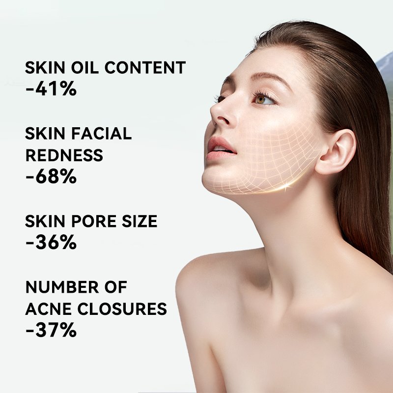 Anti-Inflammatory Anti-Bacterial Allergy-Relieving Face Cream & Lotion Oil-Control Clay Mask