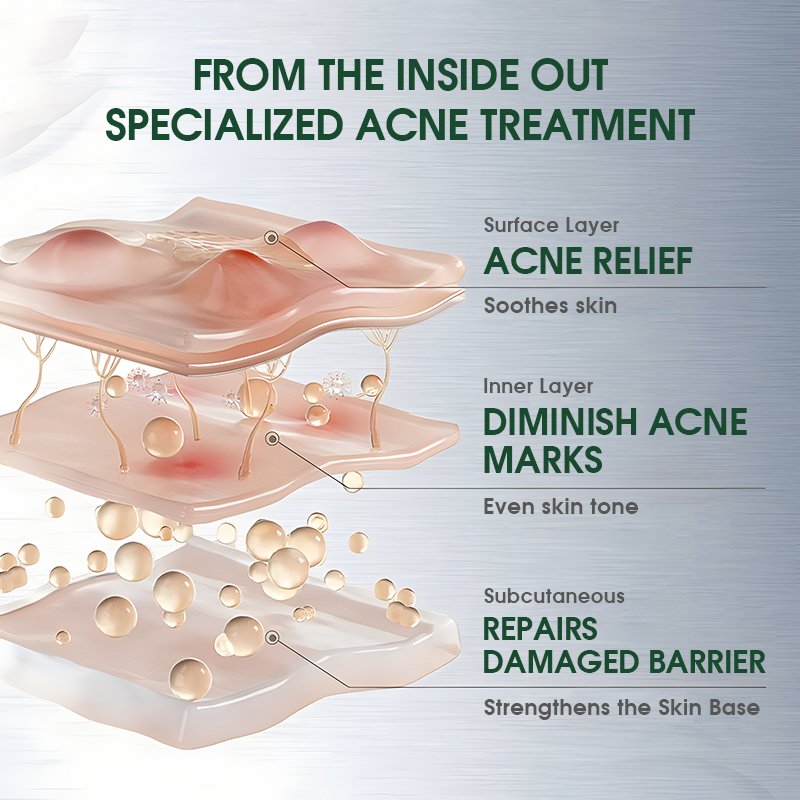 Natural Non Greasy Face Cream Cruelty-free Repair & Moisturizing and Ceramide & Tea Tree Acne Cream On The Face