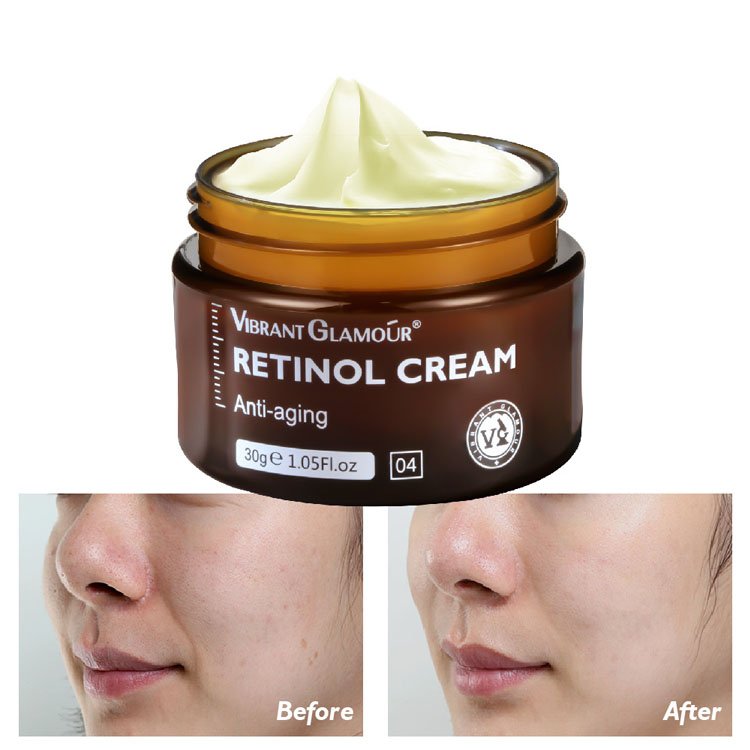 OEM/ODM Retinol Anti-Aging Remove Wrinkle Firming Lifting Whitening Brightening Moisturizing Face Cream