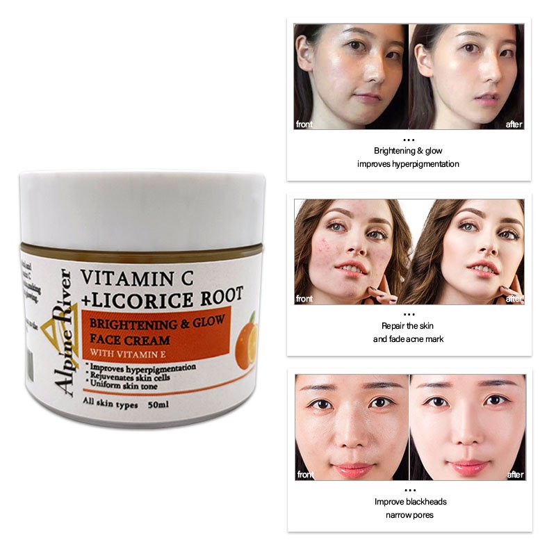 Private Label Whitening Moisturizer Vitamin C Face Cream Skin Care Set Lightening Cream