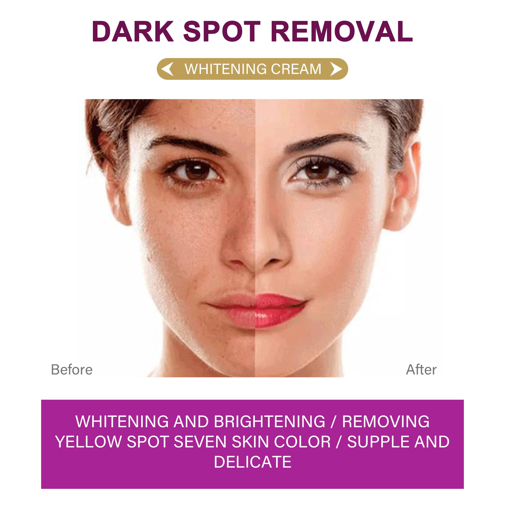 Wholesale Whitening Face and Body Cream Freckle Removal Brightening Skincare Face Cream Best Whitening Lightening Cream