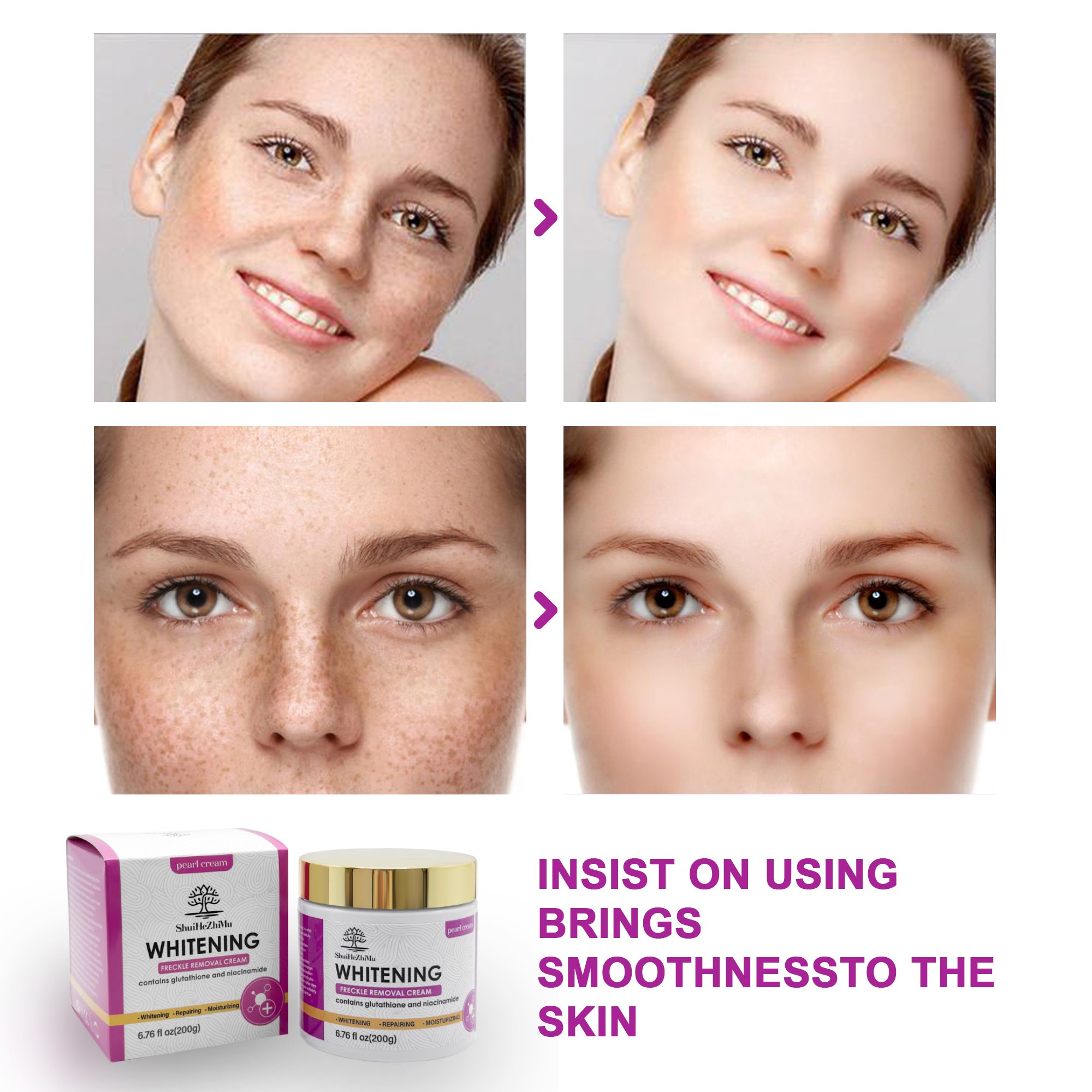 Wholesale Whitening Face and Body Cream Freckle Removal Brightening Skincare Face Cream Best Whitening Lightening Cream