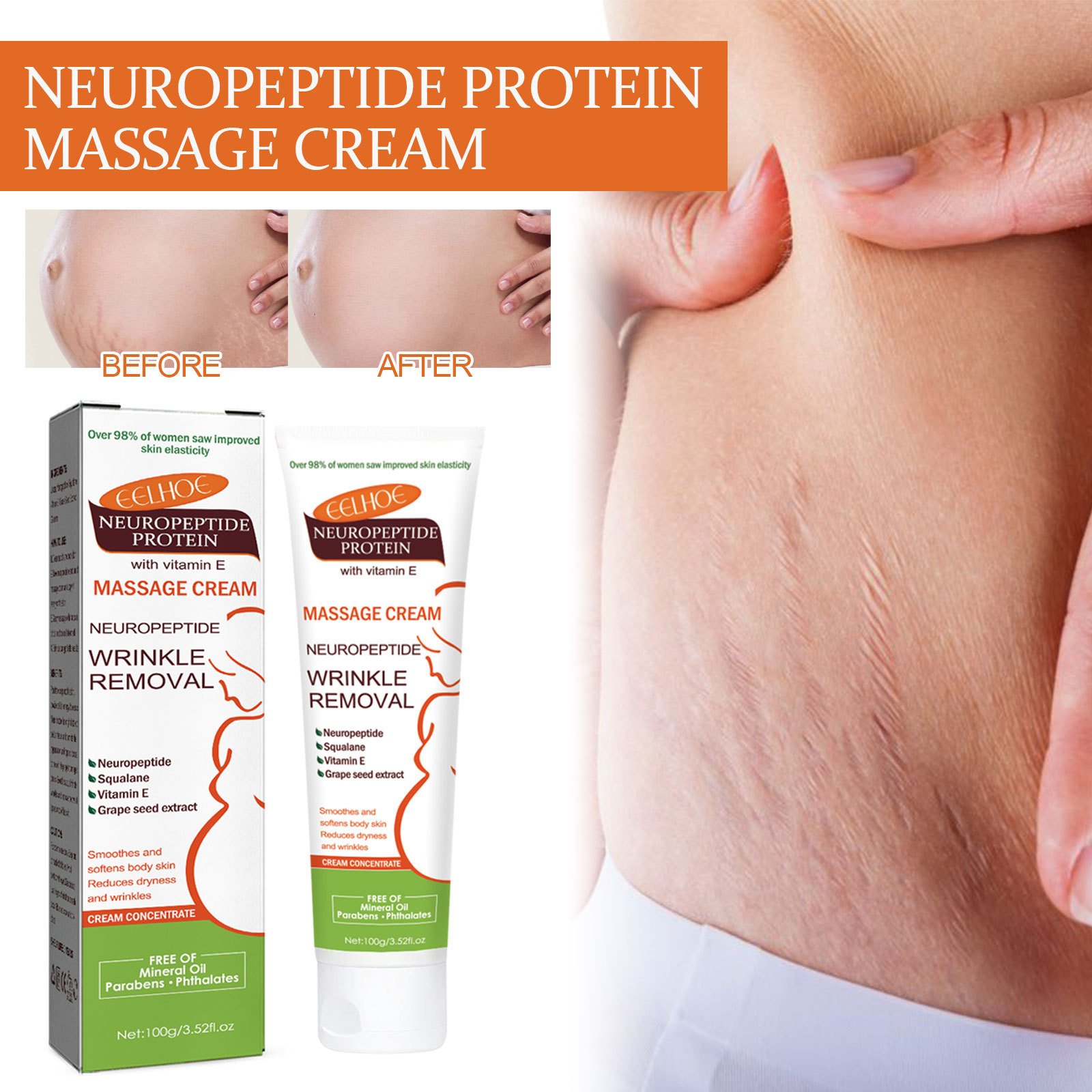 Best Selling Pregnancy Firming Removal Stretch Mark Cream in Wholesale Face Lotion Cream Day Adults Transparent Lightening Cream
