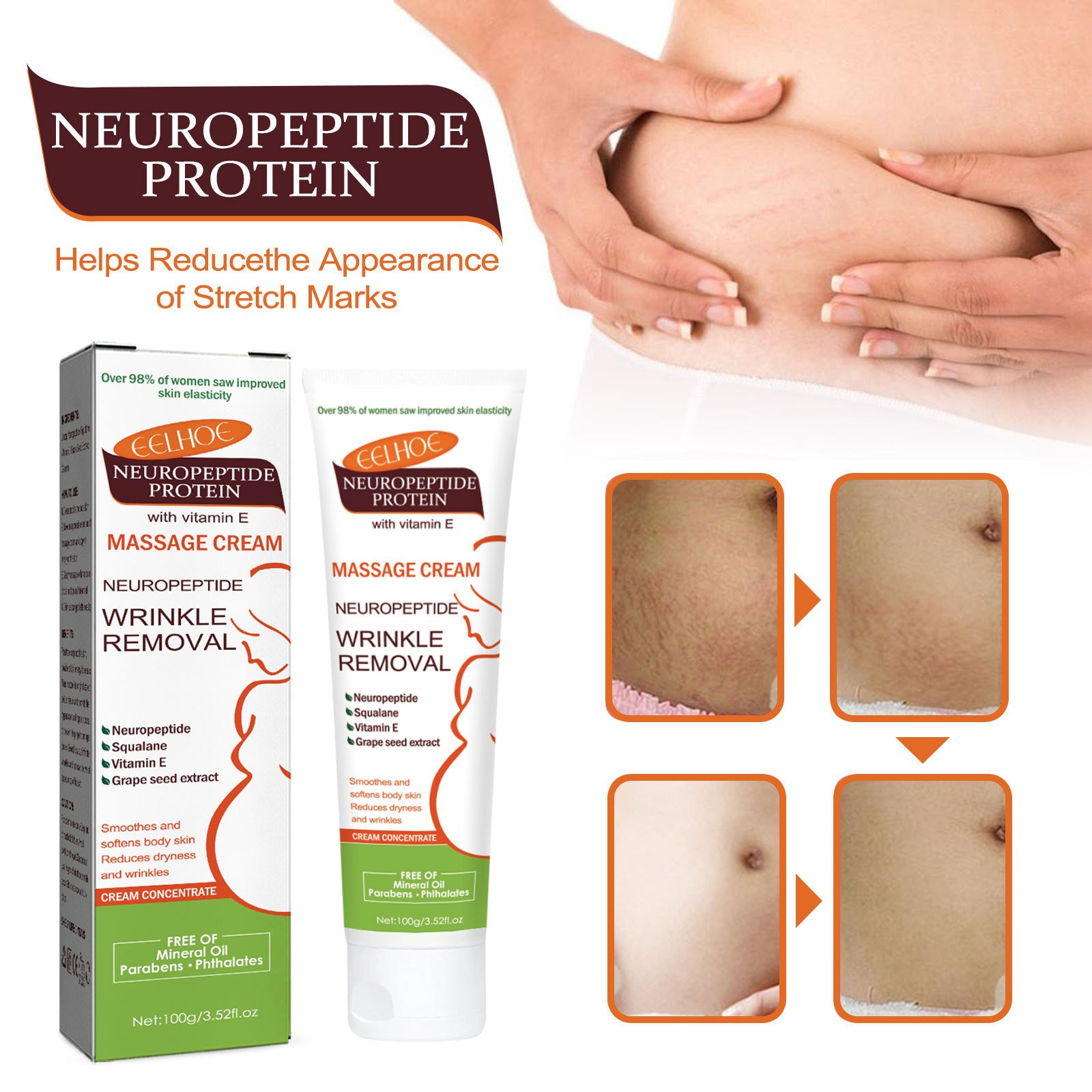 Best Selling Pregnancy Firming Removal Stretch Mark Cream in Wholesale Face Lotion Cream Day Adults Transparent Lightening Cream