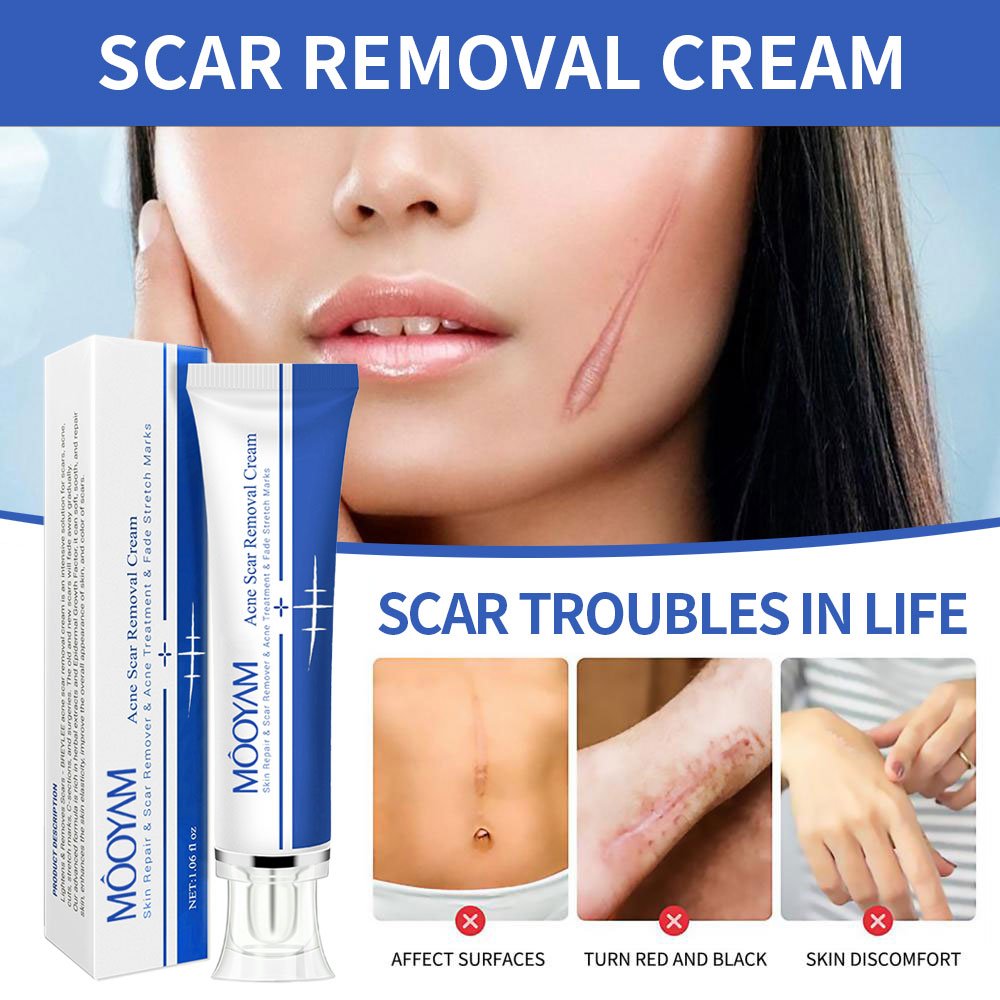 Vitamin-Infused Strong Effective Cream for Acne Scar Pimple Stretch Mark Removal Face Gel Tummy Tuck Tightening Cream Body Use