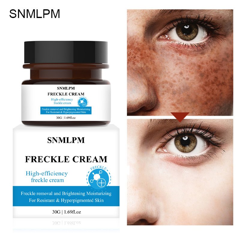 Private label Freckle cream Moisturizing Reducing melanin Whitening Brightening Face Cream for all skin types Skin Care product